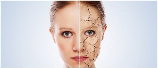 Nous traitons le psoriasis